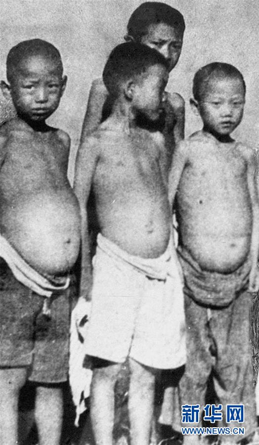 (紅土地“往事新說”·圖文互動)(6)昔日送“瘟神” 今朝健康促小康